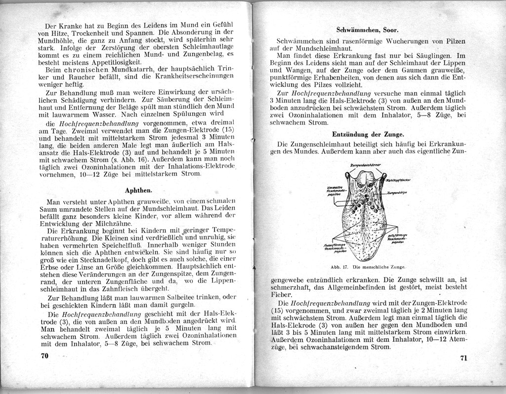 'Hochfrequenz fr Kranke und Gesunde - ein rztl. Ratgeber (1928)'